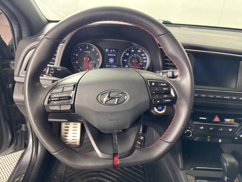 2017 Hyundai Elantra Sport