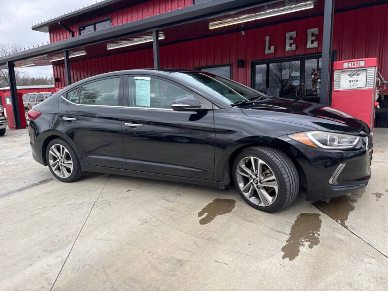 2017 Hyundai Elantra Limited's photo