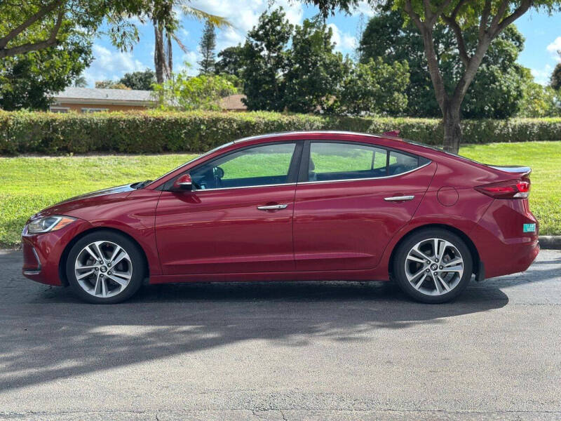 2017 Hyundai Elantra