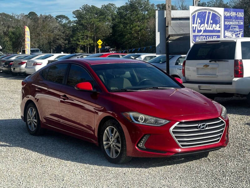 2017 Hyundai Elantra