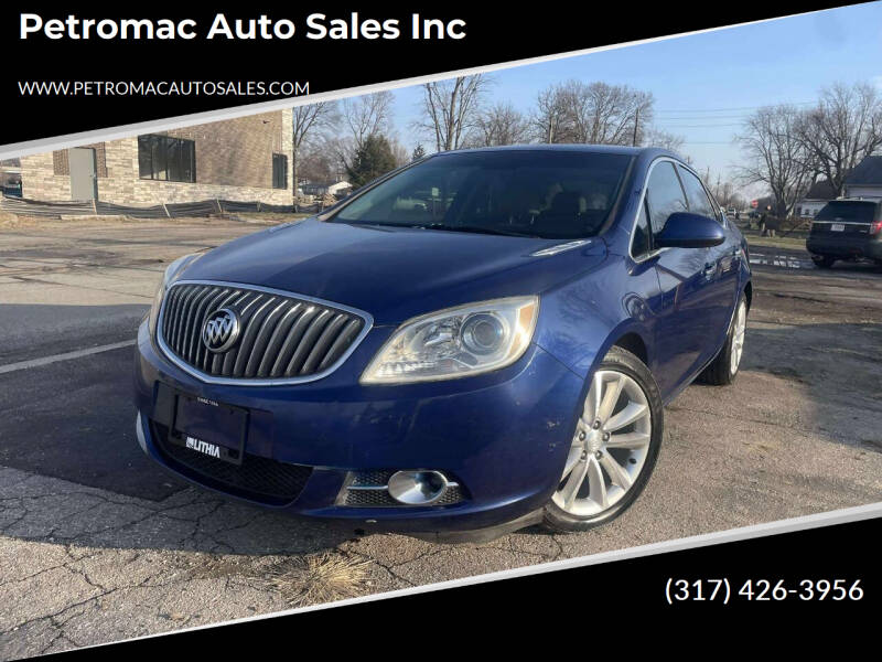 2014 Buick Verano